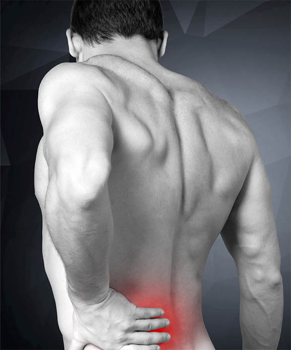 Back pain can be due to pilonidal cysts.